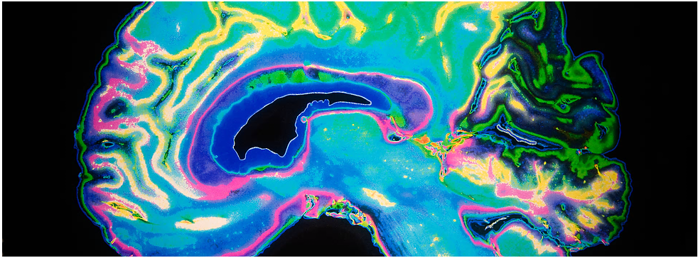 research_brain.PNG